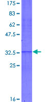 12.5% SDS-PAGE Stained with Coomassie Blue.